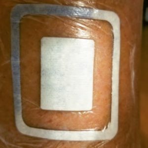 wound patch