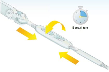 illustration of a turnbuckle