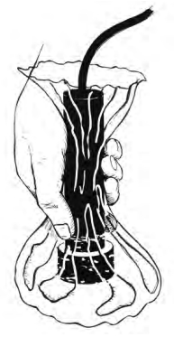 To test the viability of an internal transducer before committing to its installation, grip it in a water-filled plastic bag and hold it against your chosen site within the hull. Alternatively, but not quite as effective, press the transducer into a wad of plastic modeling clay or chewing gum. This second method is more suited to a transom transducer.