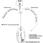 Tack route diagram