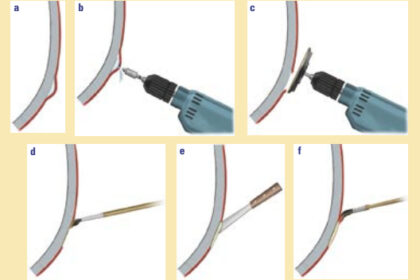 Gelcoat blisters (a) are the easiest to repair since the fiberglass beneath the gelcoat is intact. Once the blister has been drained (b) grind the overlaying layer (c), wash and dry the area, brush on a sealing coat of epoxy resin (d), fair (e), and repaint or re-gelcoat (f). Note: Below the waterline you must use coatings designed for constant immersion. Two-part polyurethanes are not recommended below the waterline.