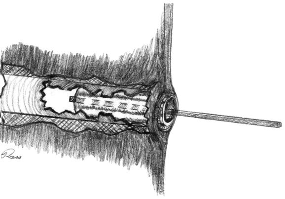 Make your own puller from steel bar stock.