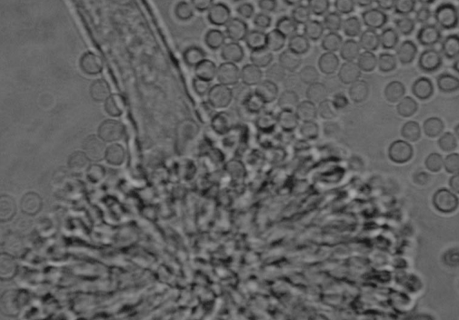 Aspergillus, a.k.a. common mildew: typically black, brown, gold, or bluegreen, mildew grows on damp surfaces and has a familiar “musty” odor.