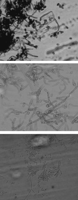 From top: Stachybotrys, a mold with an extremely high moisture requirement (a cellulose digester which likes straw, hemp, jute, and sheetrock and looking like a greasy black growth); Alternaria, a common carpet and wet windowsill mold with a high moisture requirement, looks black and fuzzy; Penicillium, another common mildew similar to the Aspergillus on Page 65 with a similiar musty odor.