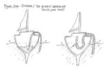 Figure One: Siphon