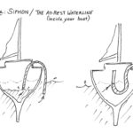 Figure One: Siphon